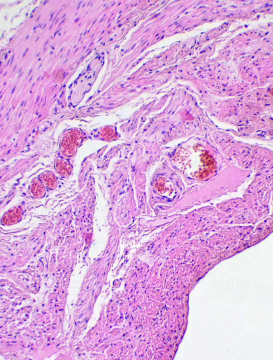 First-in-class brain-penetrant immune modulator with a differentiated mechanism and emerging clinical benefit across select tumor types.